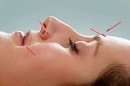 استفاده از تحریکات الکتریکی در برگشت فلج صورت